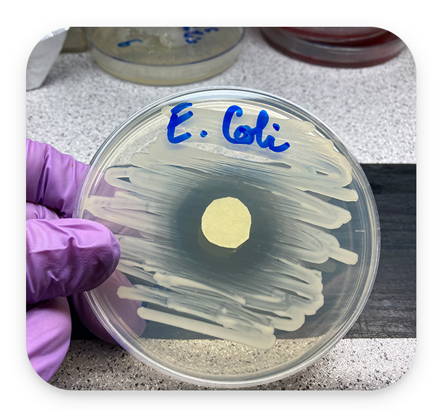 Efikasnost vaginaleta E.coli zona inhibicij