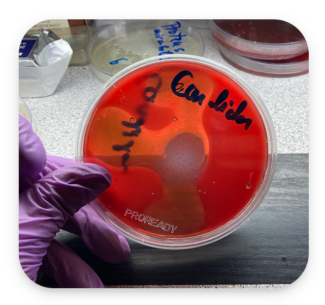 Efikasnost vaginaleta Candida zona ihibicije