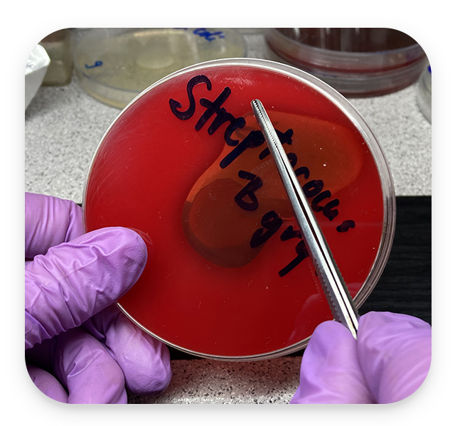 Efikasnost vaginaleta Streptococcus Beta Hemoliticu zona inhibicije